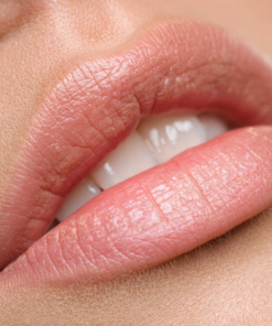 Depilación láser labio superior